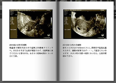 エコー写真アルバムの作り方 しまうまプリント エコー写真アルバムの作り方 しまうまプリント
