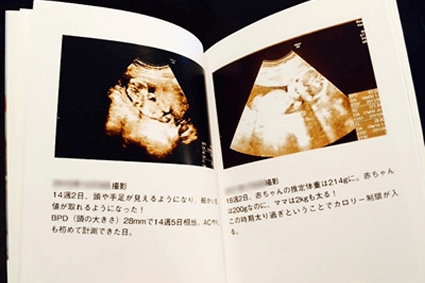 エコー写真アルバムの作り方 しまうまプリント エコー写真アルバムの作り方 しまうまプリント